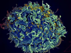 UN says if US funding for HIV programs is not replaced, millions more will die by 2029