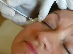 Owner of Milton medical spa pleads guilty to injecting unapproved botulinum toxin